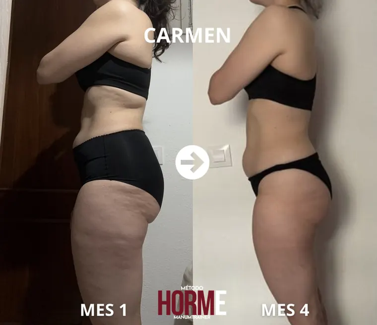 Antes y después Carmen